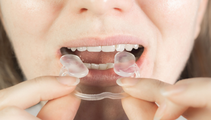 TMJ Problems Treatment in Mumbai – Dr. Aditi Chhajed