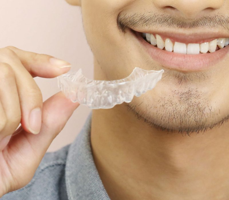 benefits of Invisalign in south mumbai